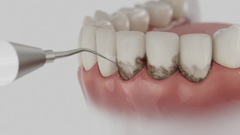 Trusted Emergency Dentist service in Fort Mill, SC - Dentist Open Now